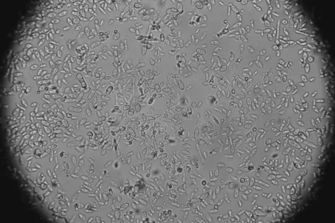 Mikroskopowy obraz dzikich drożdży w różnych stadiach rozwoju, niektóre tworzą łańcuszki.